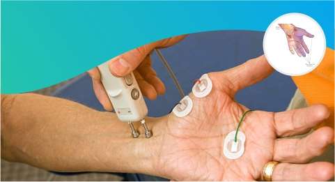 NCV - Brief Explanation On The Nerve Conduction Velocity Test